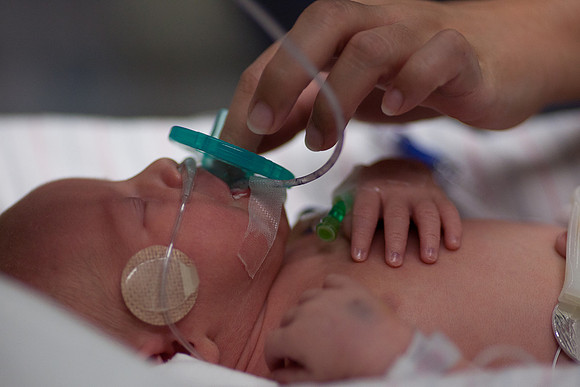 Pacifier in ICU